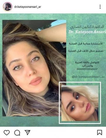 گزارش کمپین اسپانسری اینستاگرام زیبایی کتایون انصاری